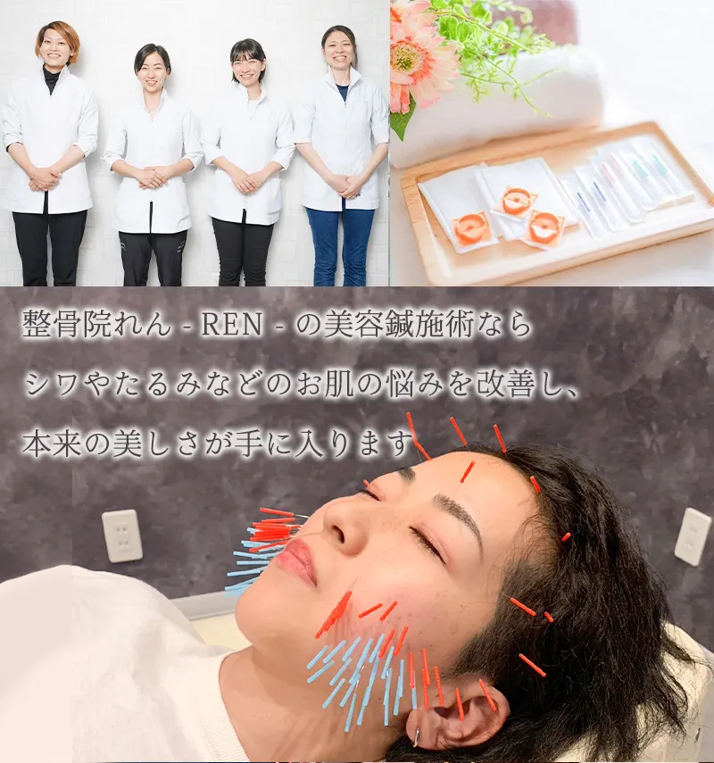 整骨院れん-REN- 美顔鍼