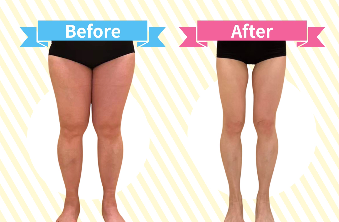 ビフォーアフター