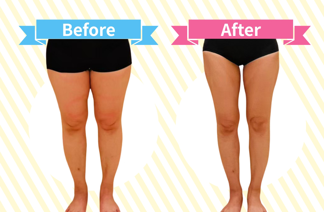 ビフォーアフター