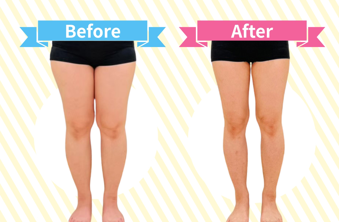 ビフォーアフター