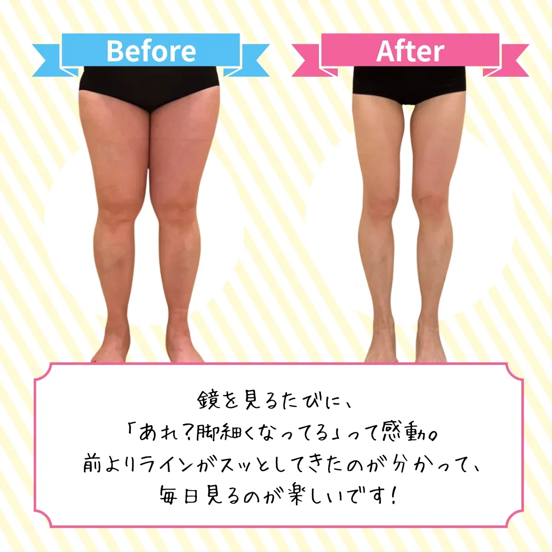 脚のビフォーアフター1