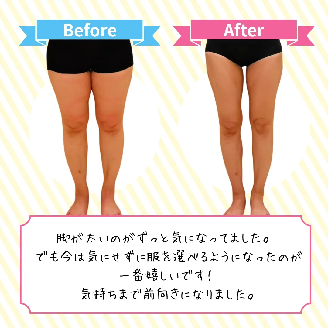 脚のビフォーアフター2