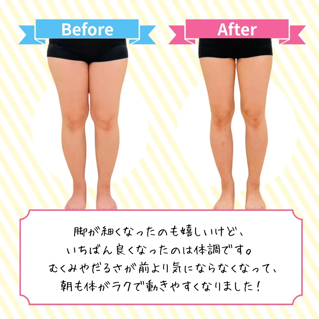 脚のビフォーアフター3